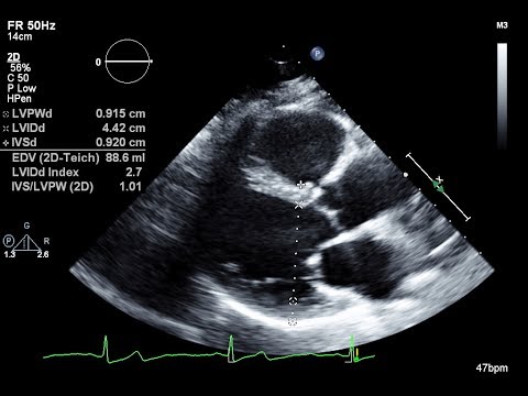 2D Echo service image