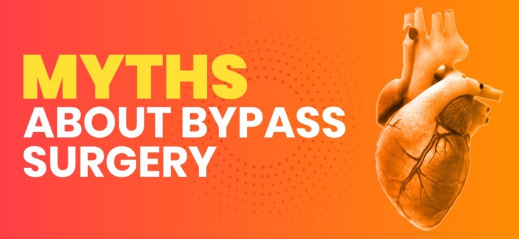 Myths About Bypass Surgery