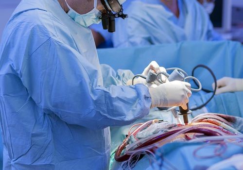 bypass surgery
