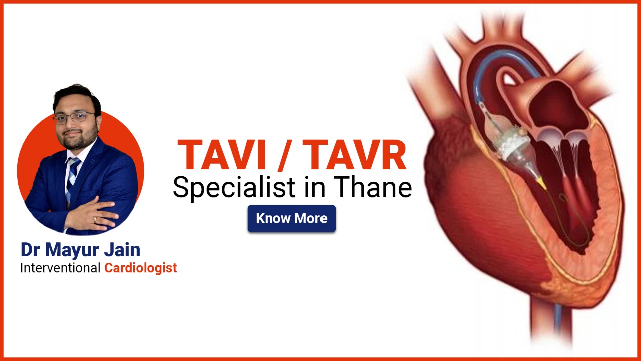 Tavi